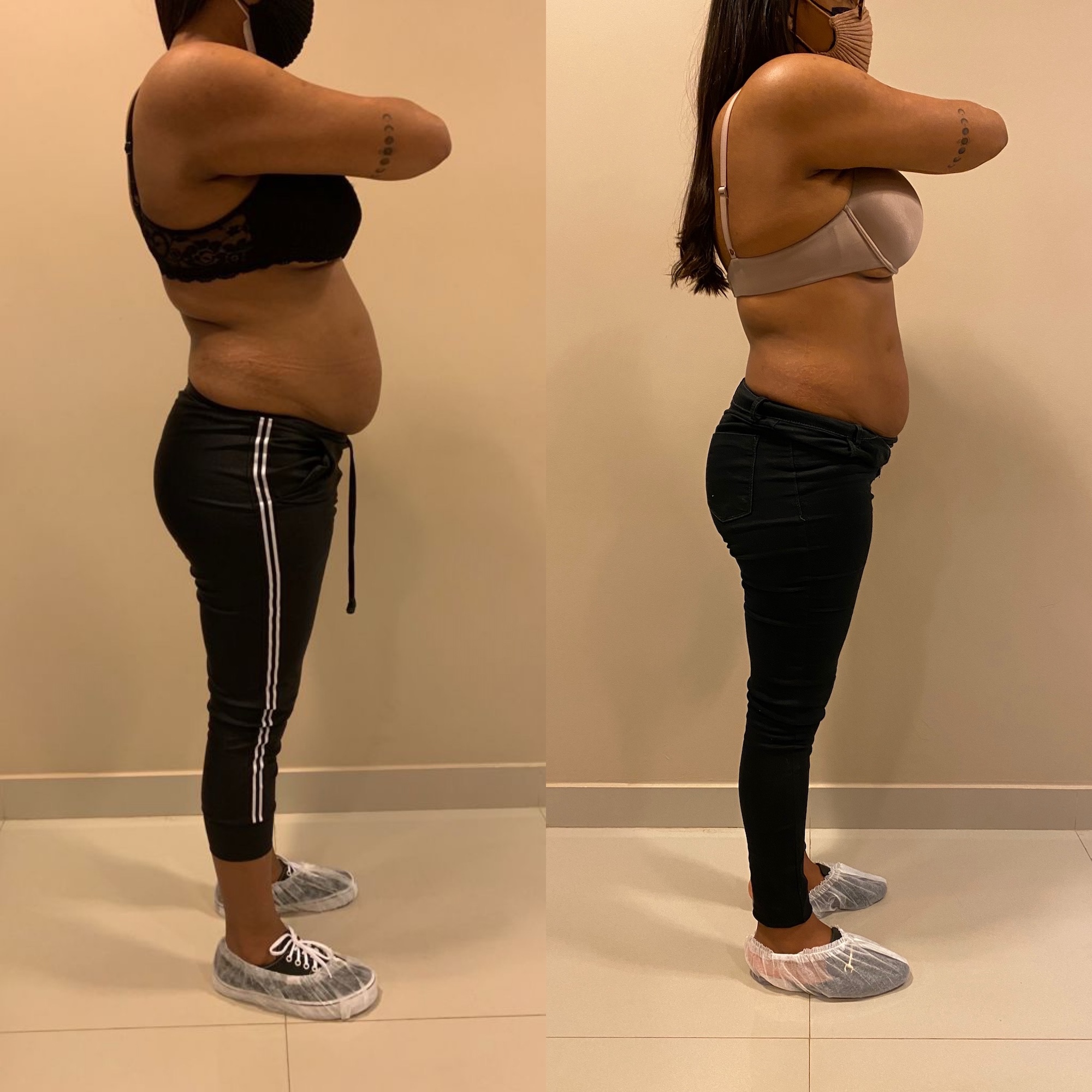 Antes e depois — corpo reorganizado, volume, postura e força de volta