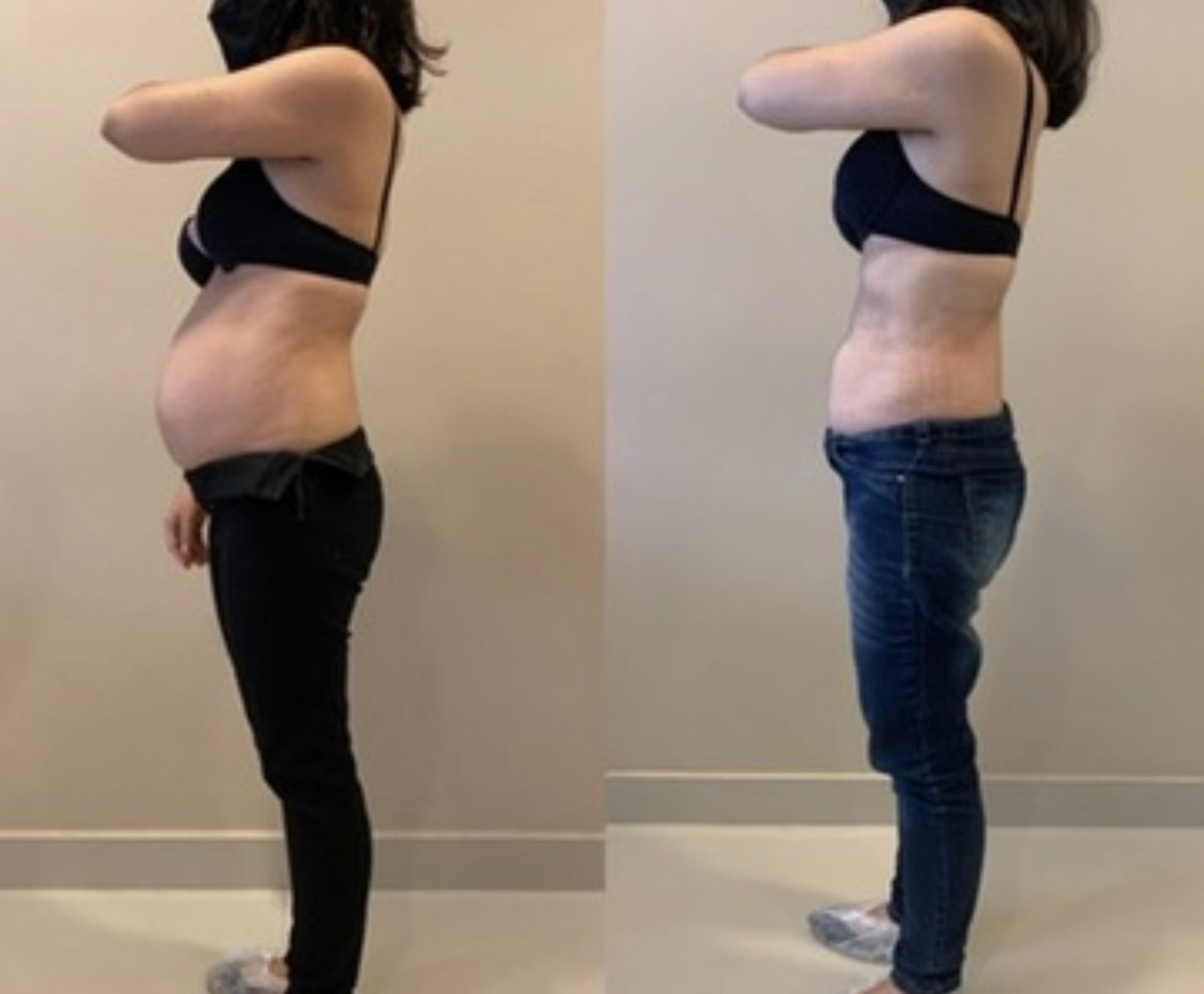 Antes e depois — transformação pós-parto em 4 encontros