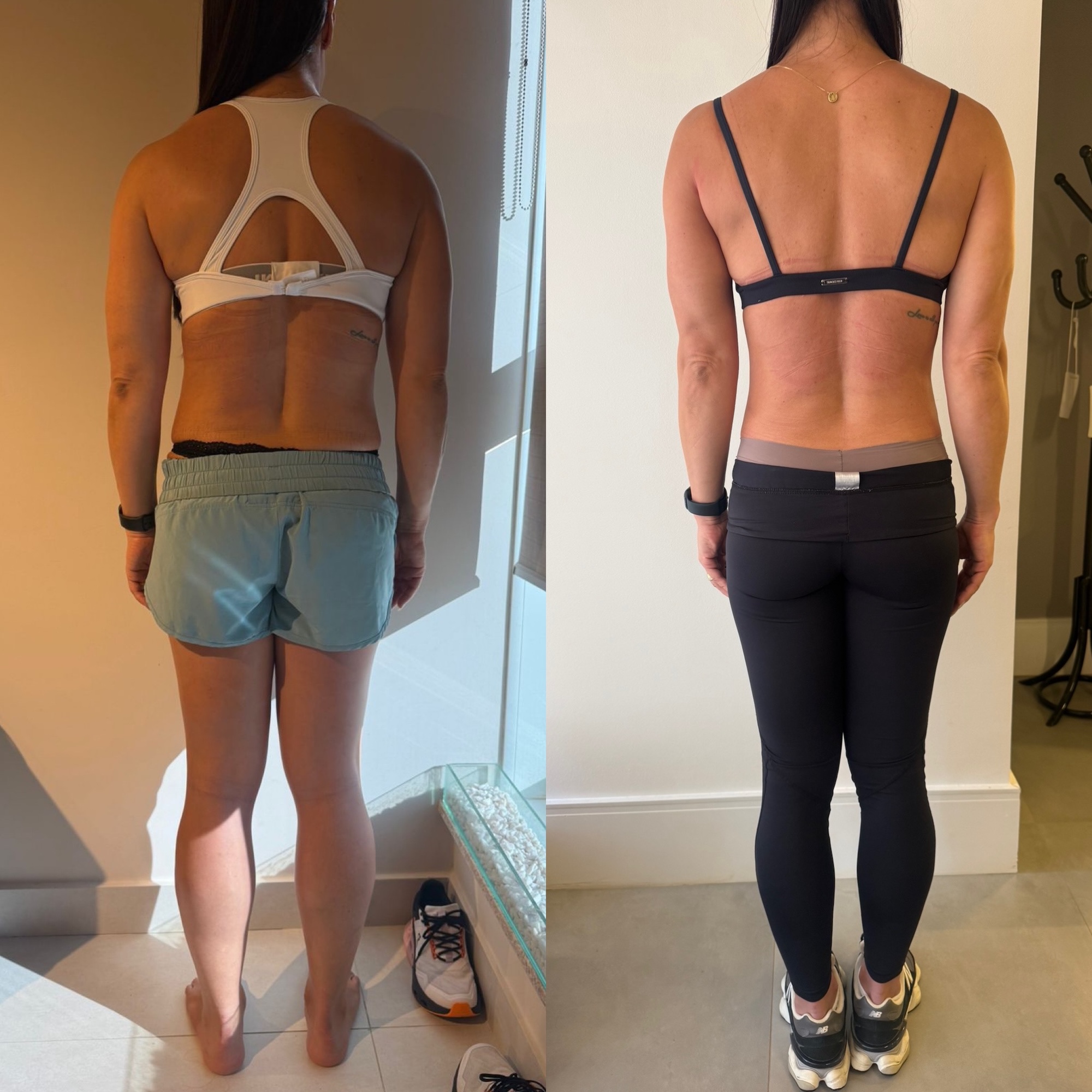Antes e depois — postura transformada, ombros e costas alinhados