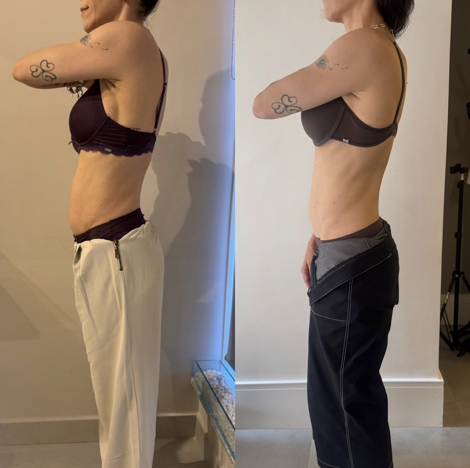 Antes e depois — coluna alinhada em vista lateral